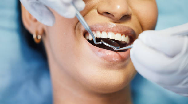 Best Broken Tooth Emergency  in Glenwood, MN
